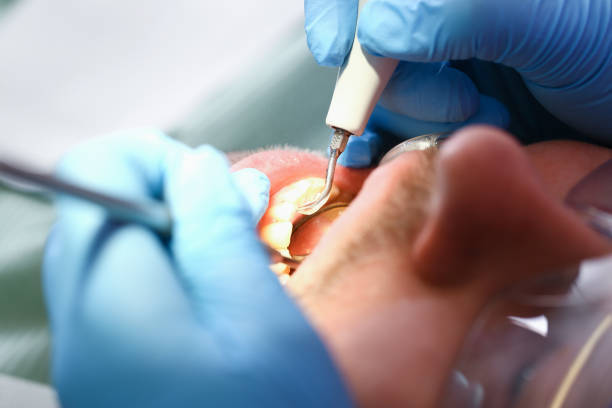 Best Emergency Treatment for Oral Infections in Inverness, CA