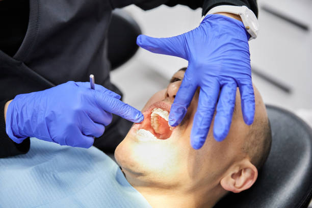 Best Emergency Denture Repair in Inverness, CA