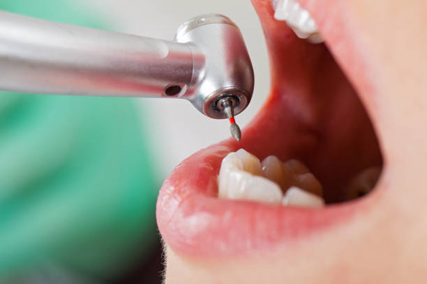 Best Emergency Pediatric Dental Care in Inverness, CA